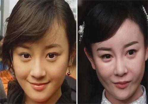 女明星网红整形失败,女明星整形失败案例警示录