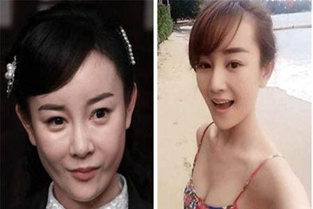 女明星网红整形失败,女明星整形失败案例警示录