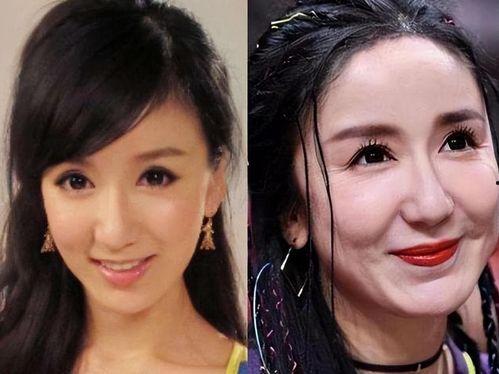 女明星网红整形失败,女明星整形失败案例警示录