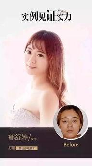变美明星网红图片,如何打造令人惊艳的变美之路